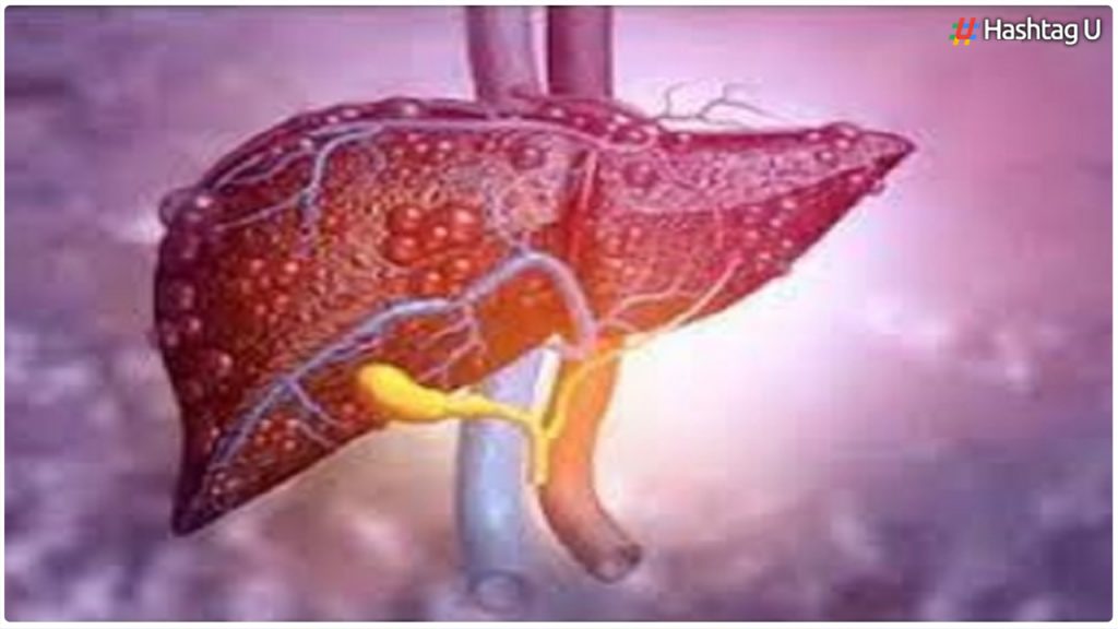 Non Invasive Therapy Promising For Liver Cancer Patients