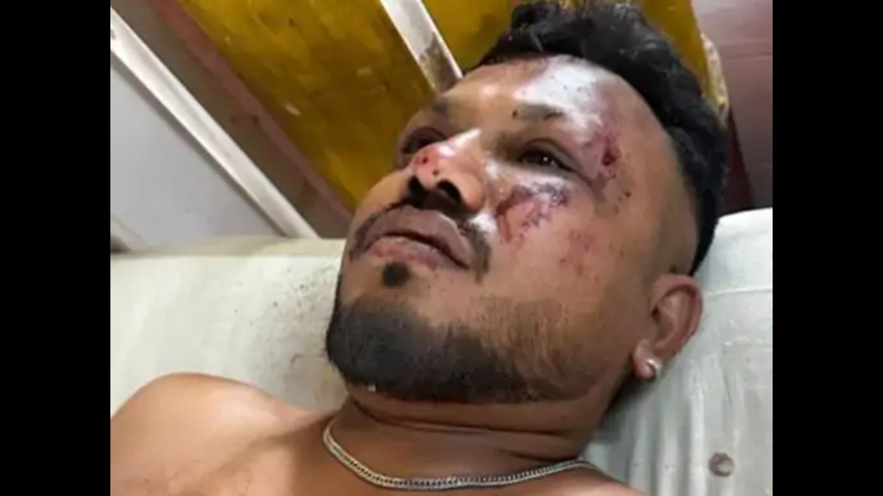 Air India क्रैश का इकलौता जिंदा बचे यात्री विश्वास कुमार का पहला बयान: “एक पल को लगा मैं भी मर जाऊंगा…”